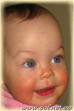 Grete Helena; 11-kuud; Eesti, Tallinn, Mustam�e