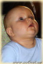 Анастасия Толочко; 8 месяцев; Россия