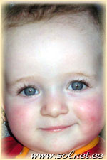 Шели; 10 месяцев; Израиль, Хайфа