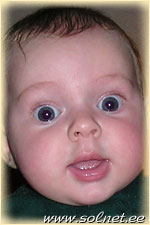 Станислав Яковлев; 4 месяца; Украина Шостка